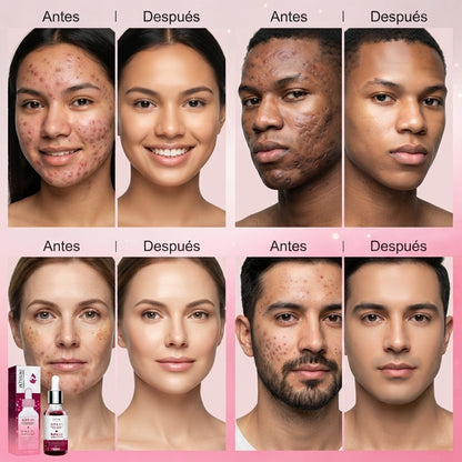 Sérum Dermalux - Piel Más Uniforme, Sin Manchas ni Imperfecciones - 30ml