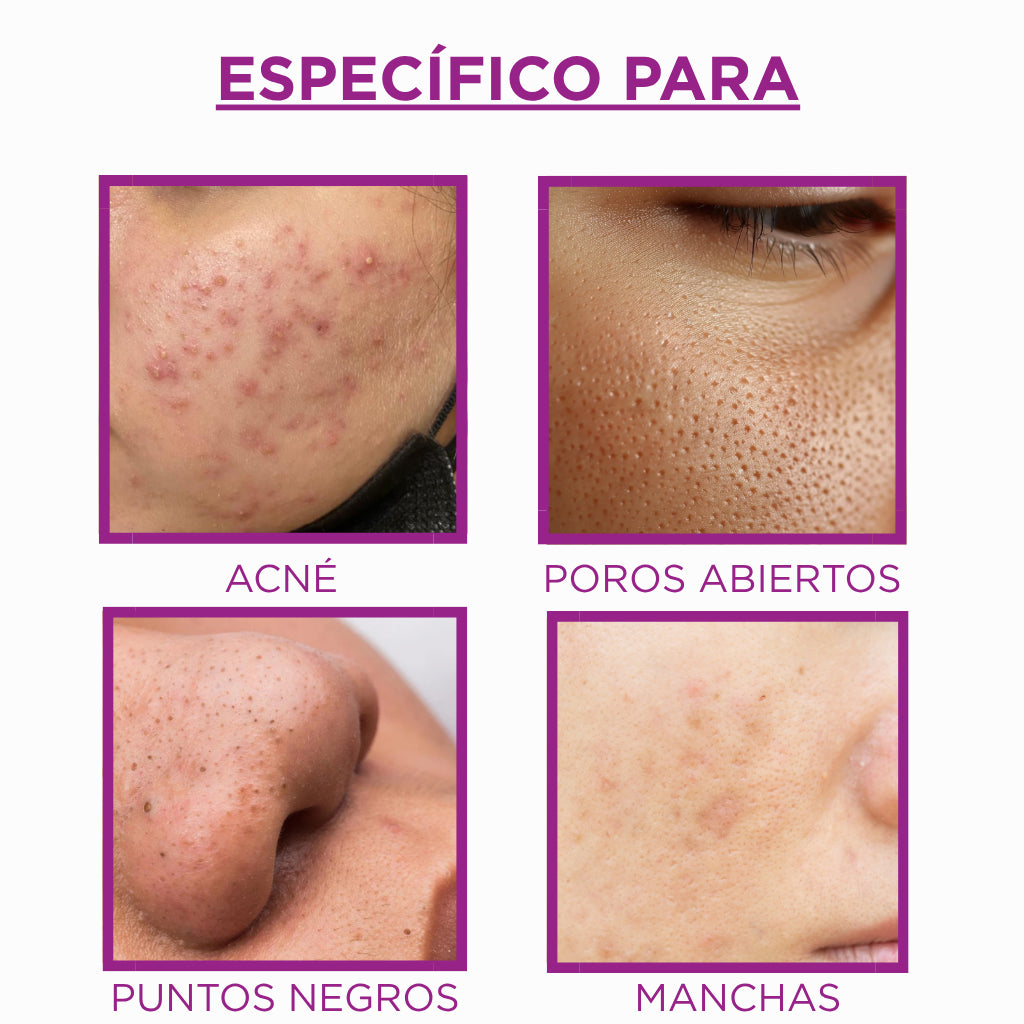 Sérum Dermalux - Piel Más Uniforme, Sin Manchas ni Imperfecciones - 30ml