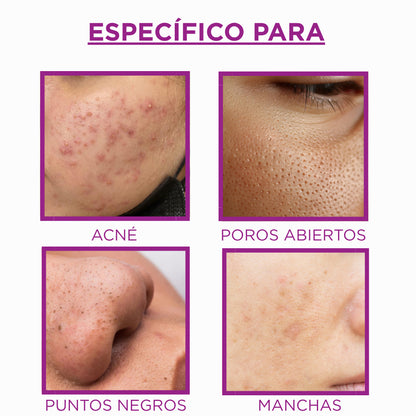 Sérum Dermalux - Piel Más Uniforme, Sin Manchas ni Imperfecciones - 30ml